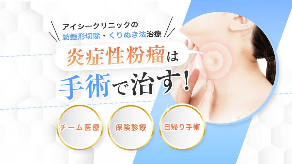 炎症性粉瘤の症状と治療