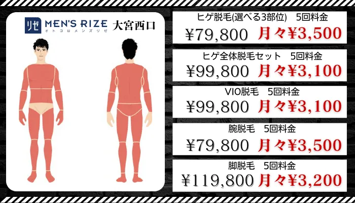 メンズリゼ大宮比較料金