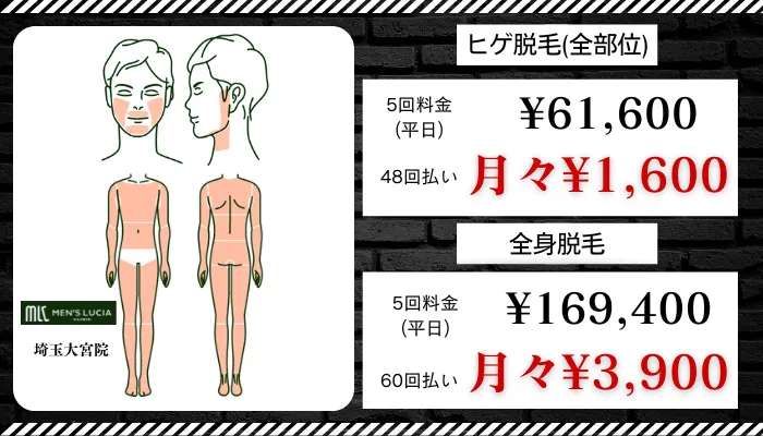 メンズルシアクリニック大宮比較ヒゲ、全身料金