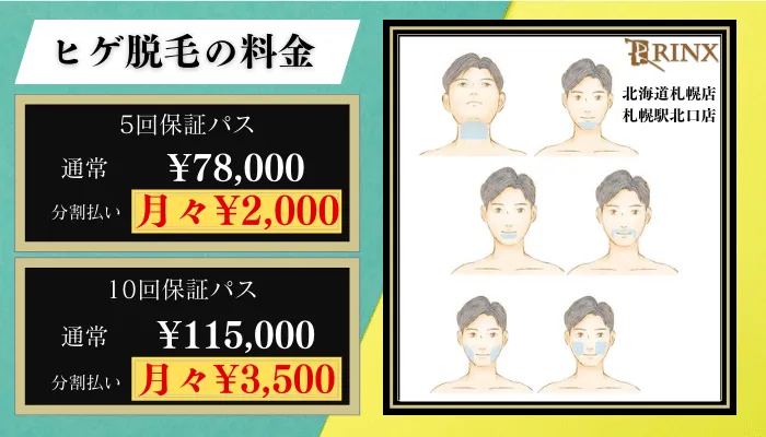 リンクス札幌脱毛料金比較