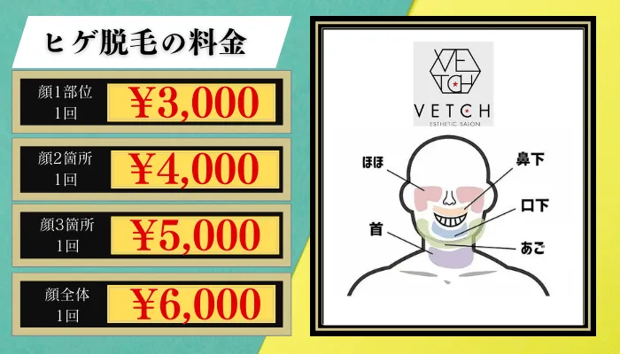 VETCH脱毛料金比較