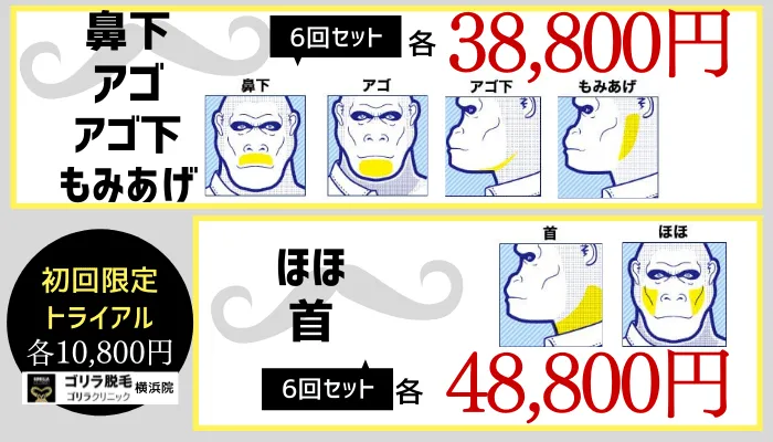 ゴリラクリニック横浜院ヒゲパーツ脱毛料金