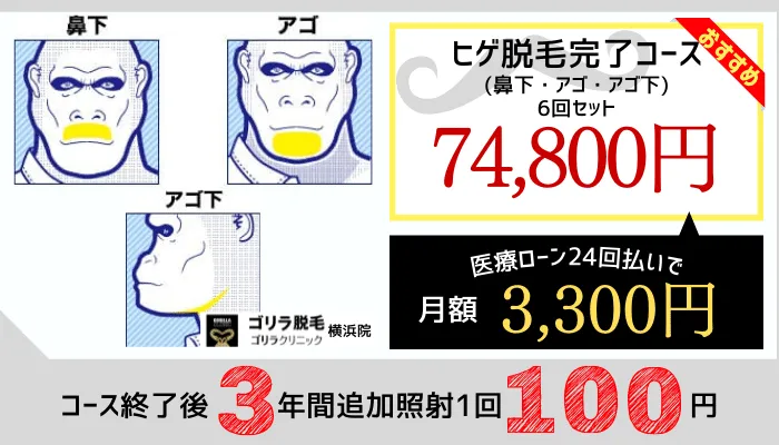 ゴリラクリニック横浜院ヒゲ脱毛料金