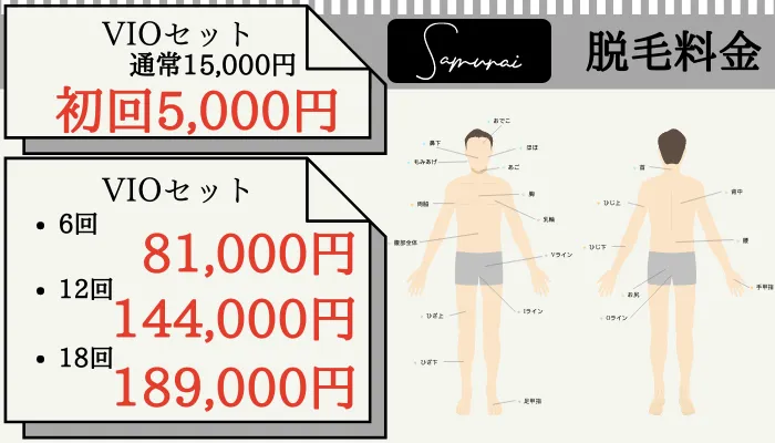 メンズ脱毛旭川サムライVIO脱毛料金