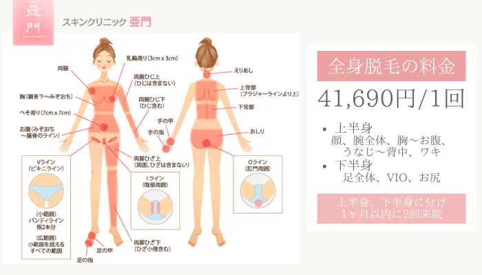 スキンクリニック亜門全身脱毛料金