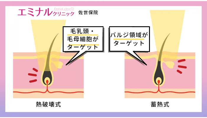 エミナルクリニック佐世保熱破壊式と蓄熱式