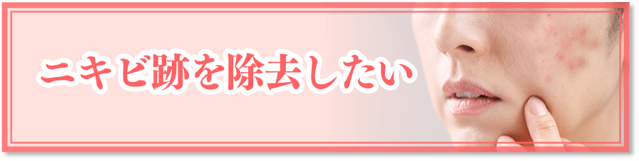 ニキビ跡を除去したい