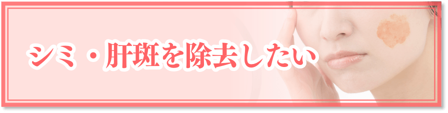 シミ・肝斑を除去したい