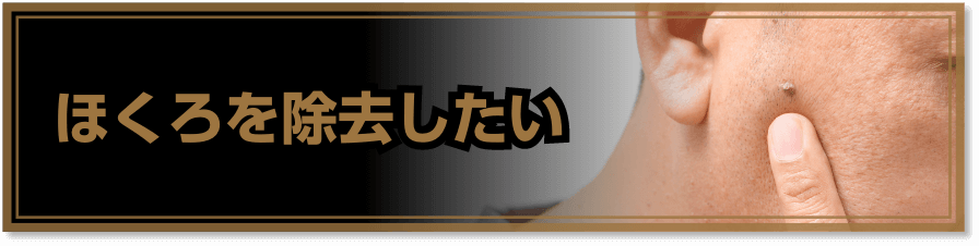 ほくろを除去したい