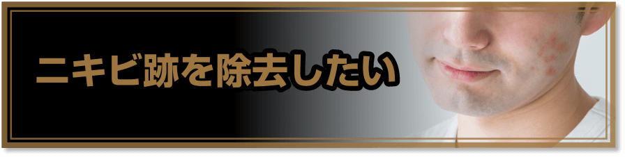 ニキビ跡を除去したい