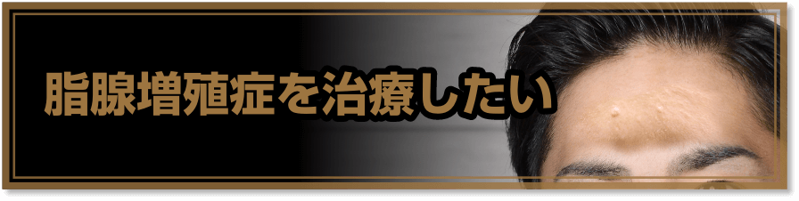 脂腺増殖症を治療したい