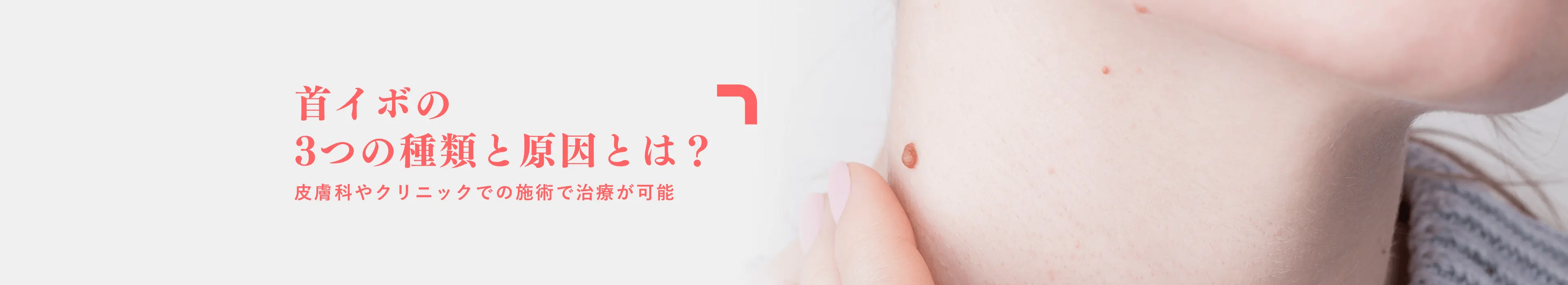 アイシークリニックの女性治療メニュー