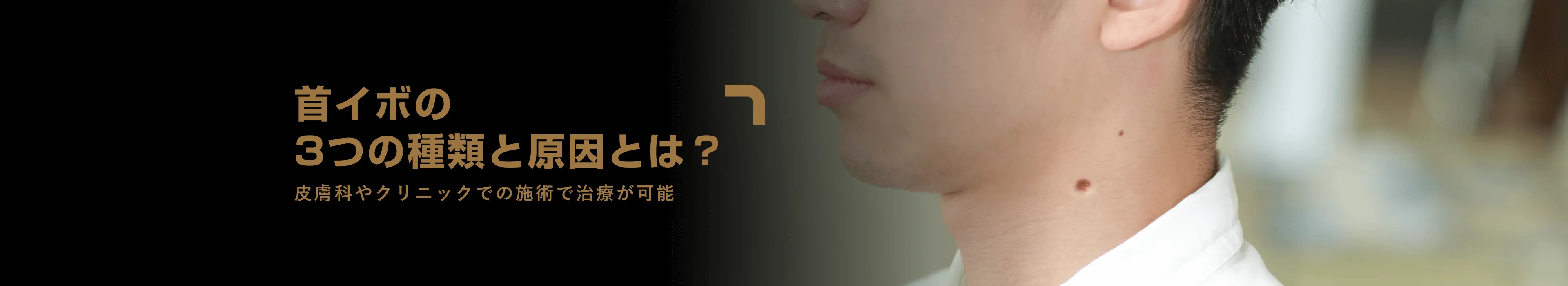 アイシークリニックの男性治療メニュー