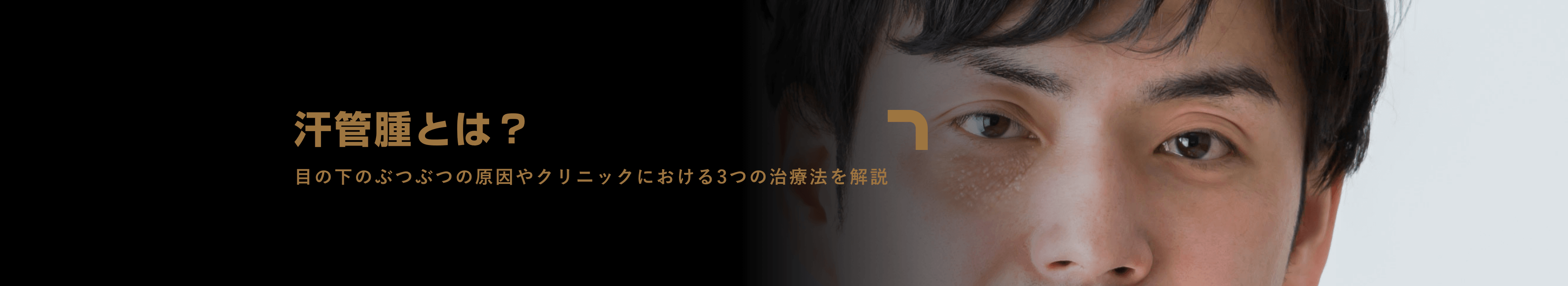 アイシークリニックの男性治療メニュー