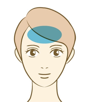 額
