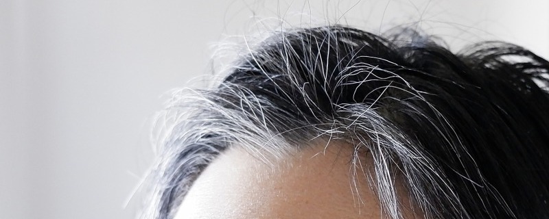 アロビックスの効果 | 脱毛症や白斑の改善